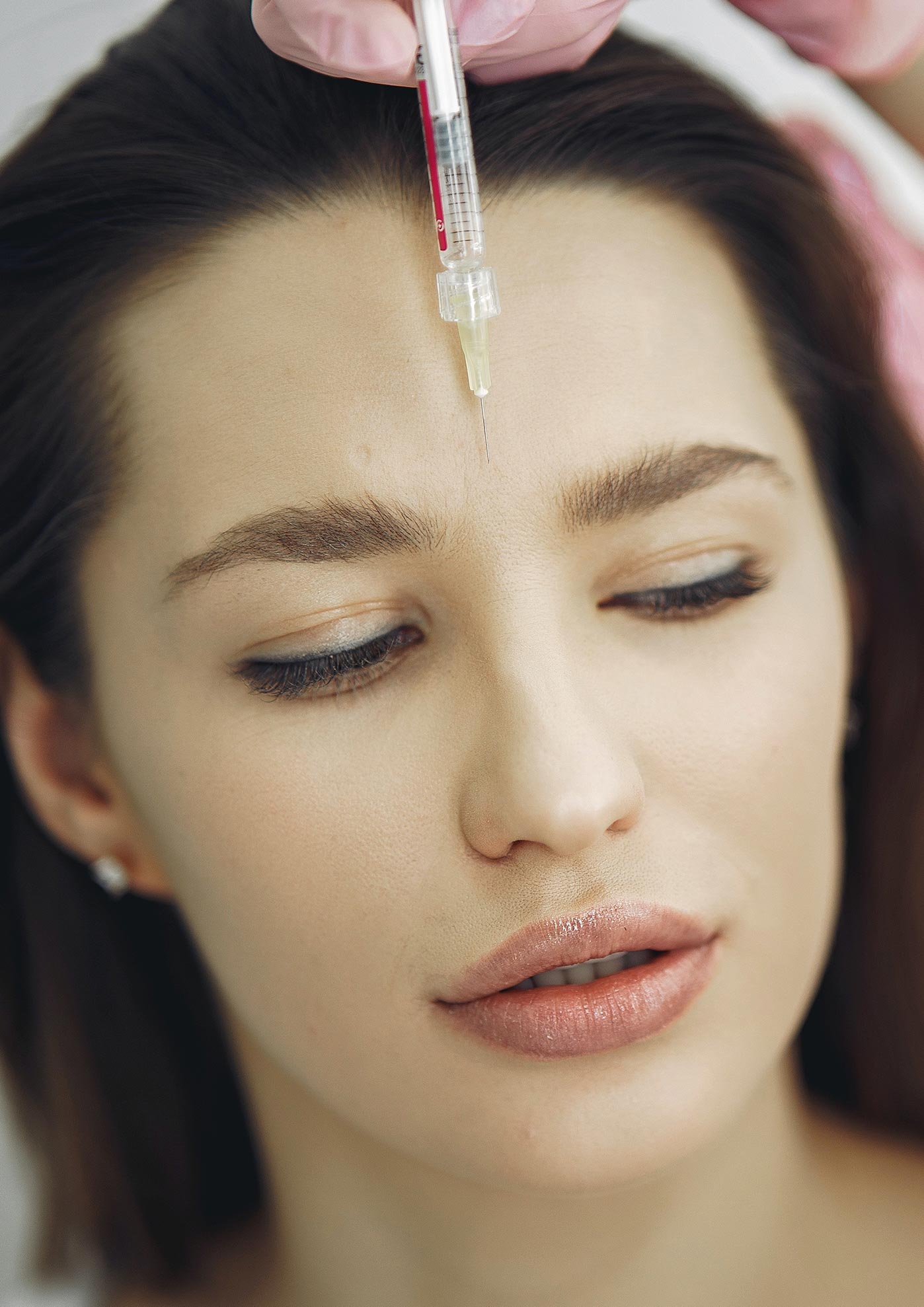 Baby Botox or Preventative Botox