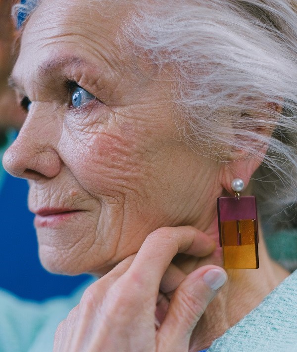 All you would like to know about skin aging!?