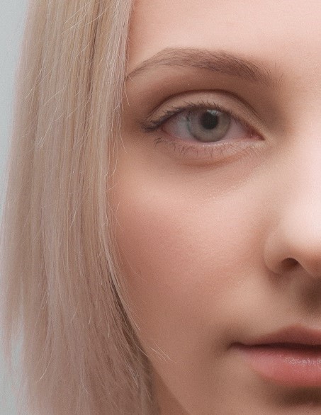 How Botox and Fillers work on Eye Rejuvenation?
