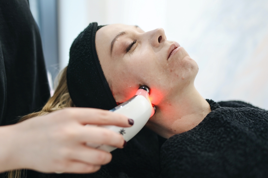 An Ultimate Guide On AviClear Laser For Acne Treatment