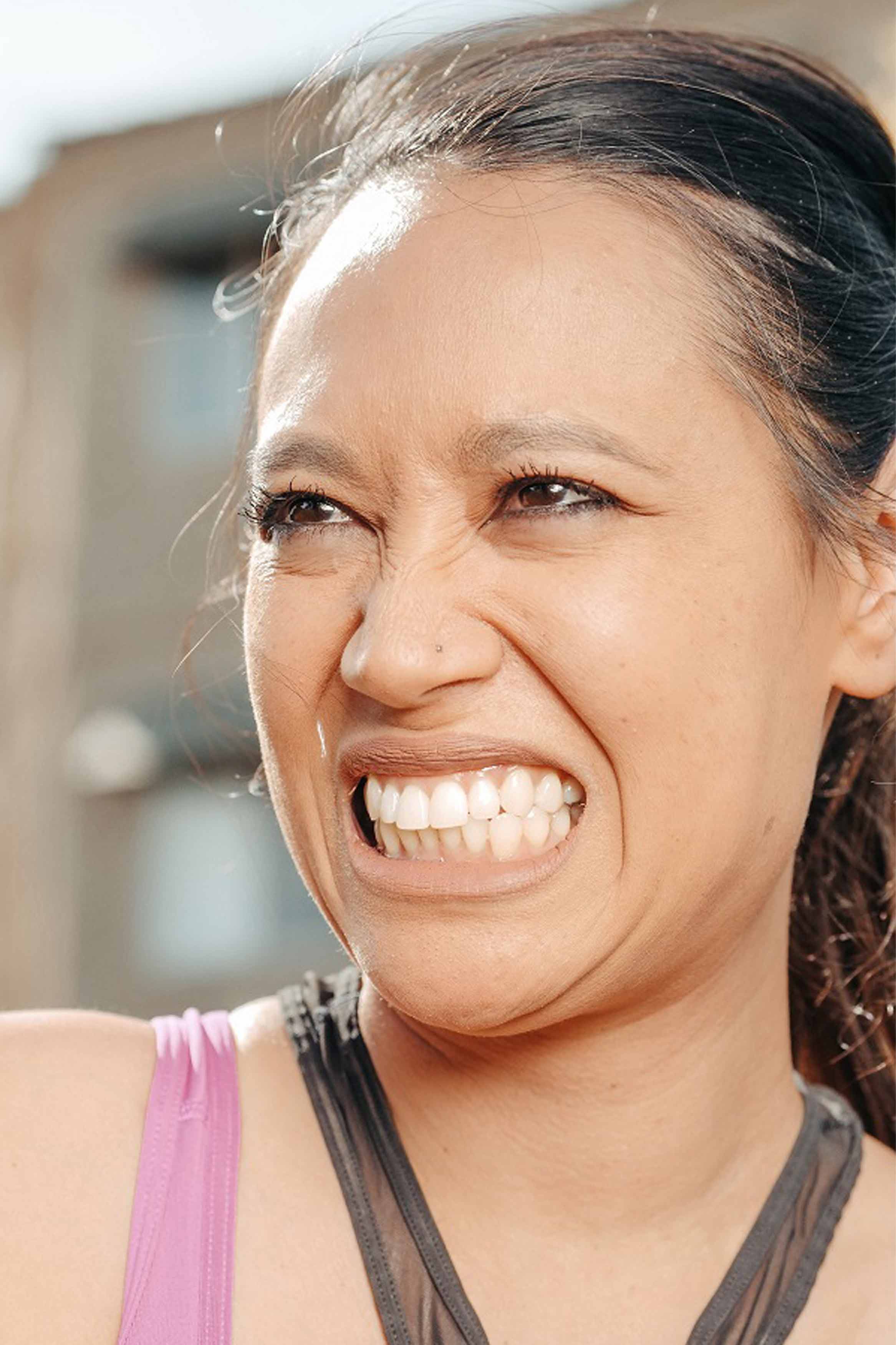 How Botox does work in treatment of Teeth Grinding?